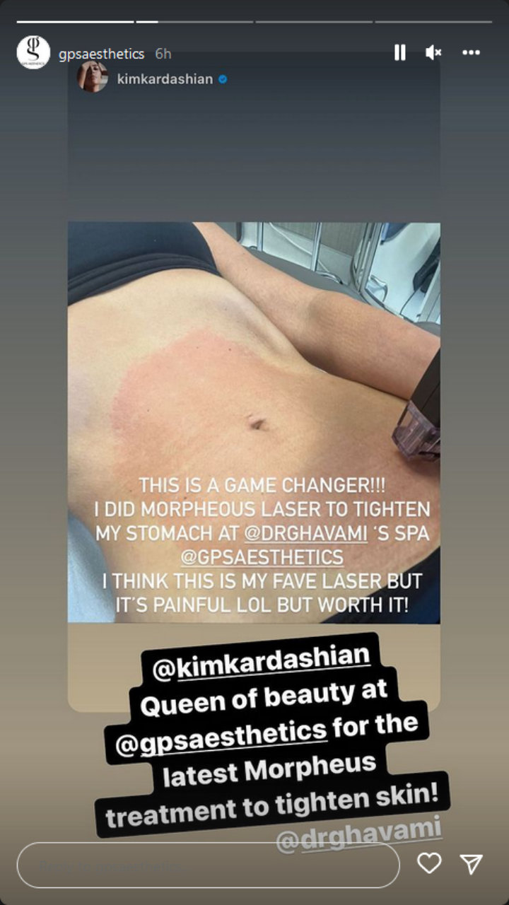 Kim Kardashian's IG Story