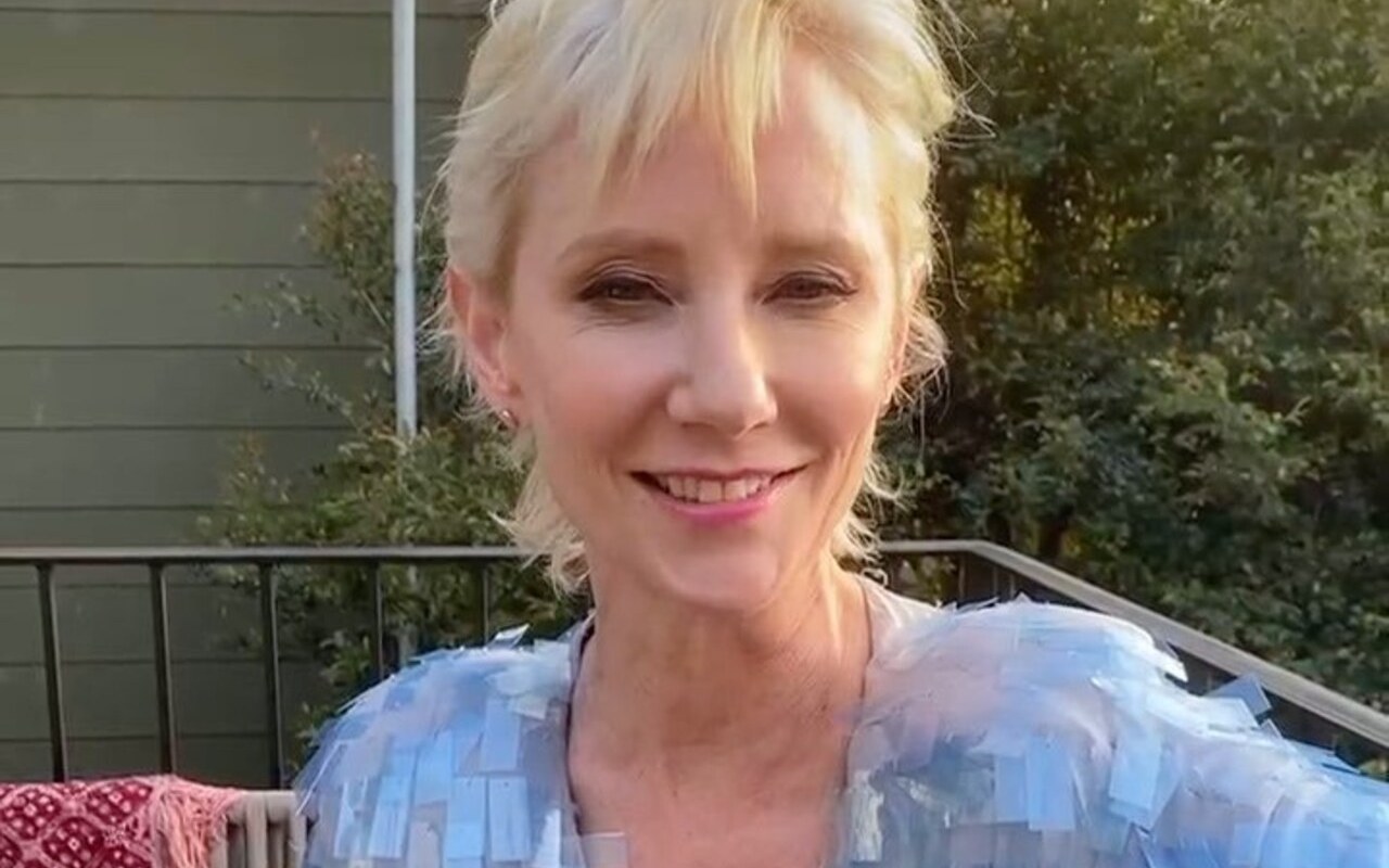 Anne Heche Trapped in Burning House for 45 Minutes Before Firefighters Rescued Her
