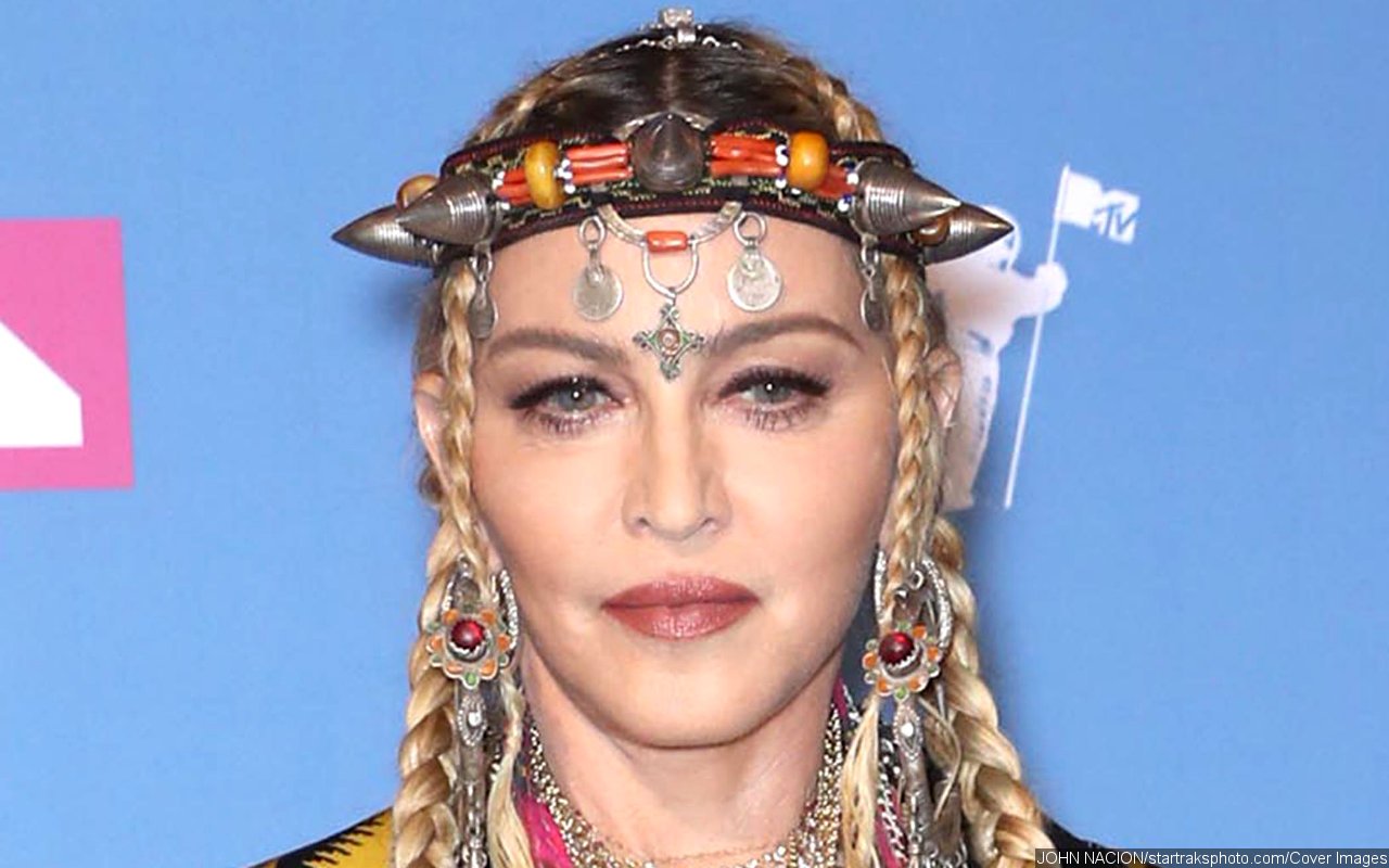 Madonna May Have Taken Plastic Surgery and Cosmetic Procedures 'Little Too Far,' Says Experts - Vimarsana News