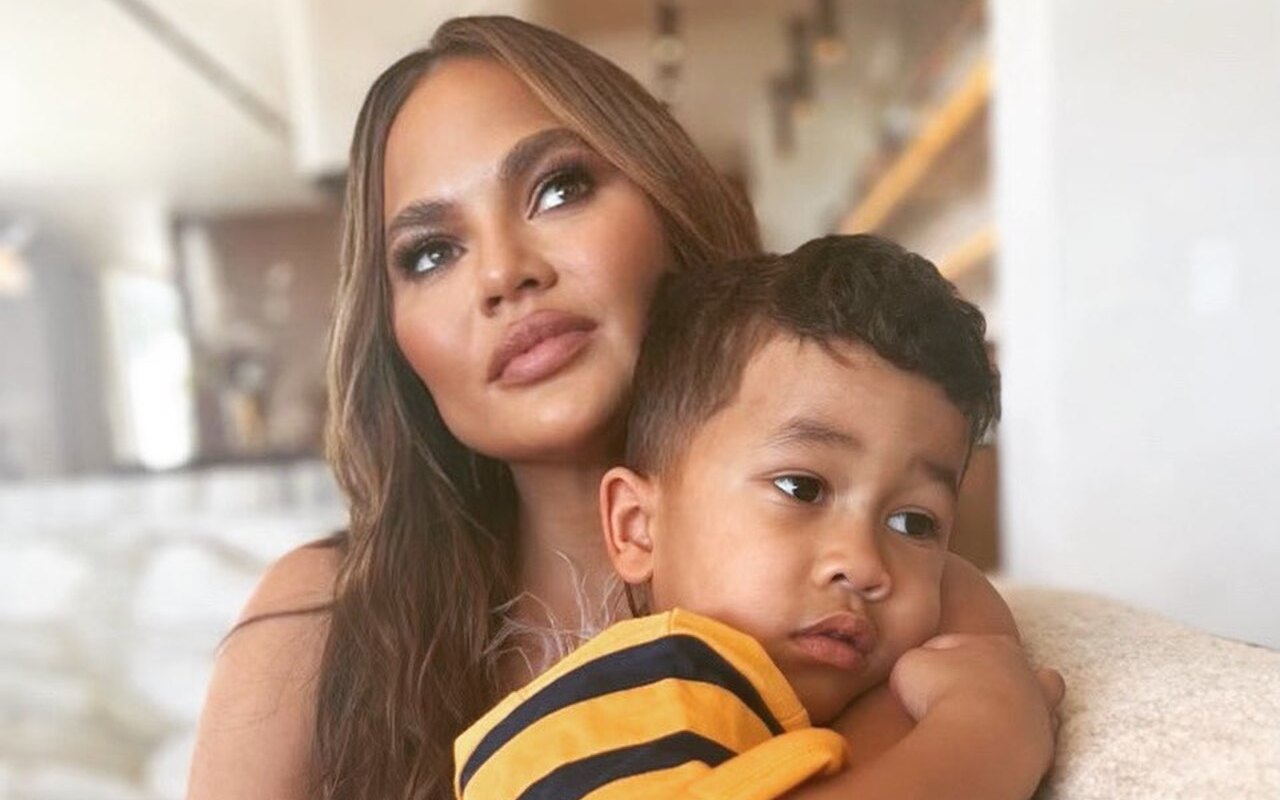 Chrissy Teigen's Son Needs Stitches on His Forehead After Getting