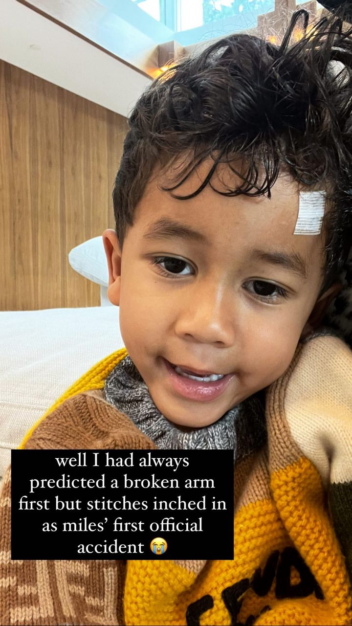 Chrissy Teigen's son has got stitches