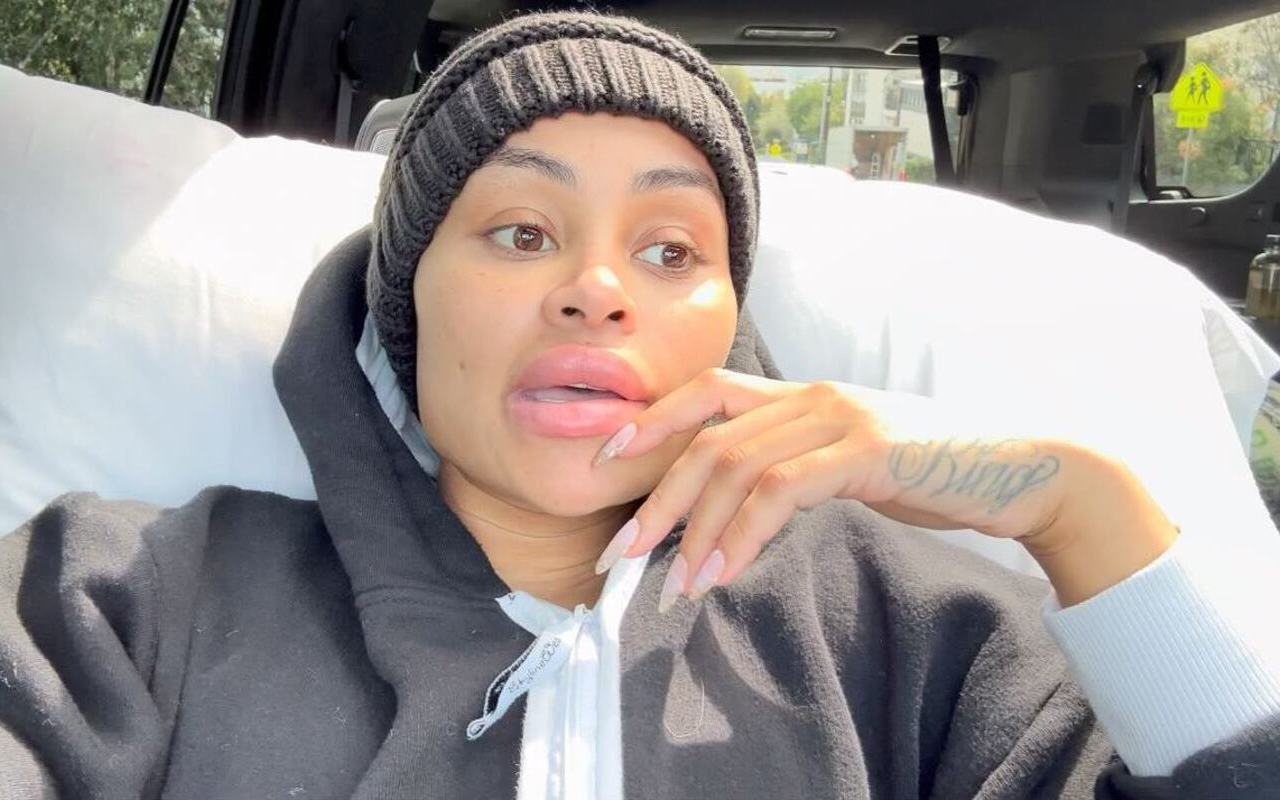 Blac Chyna to Get Rid of Face Fillers and 'Long Stiletto Nails' After Breast and Bum Reductions