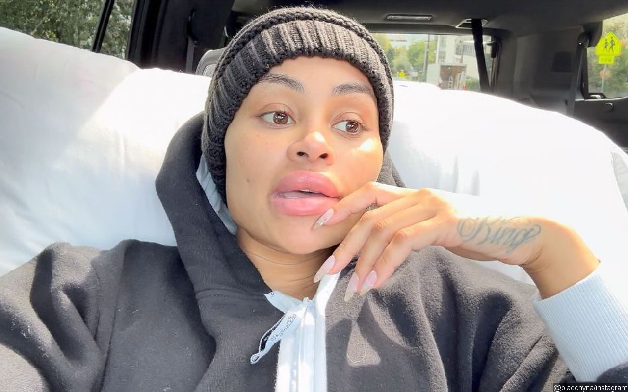 Blac Chyna 'Happy' After Removing All of Her Face Fillers