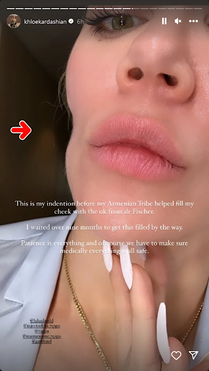 Khloe Kardashian's IG Story