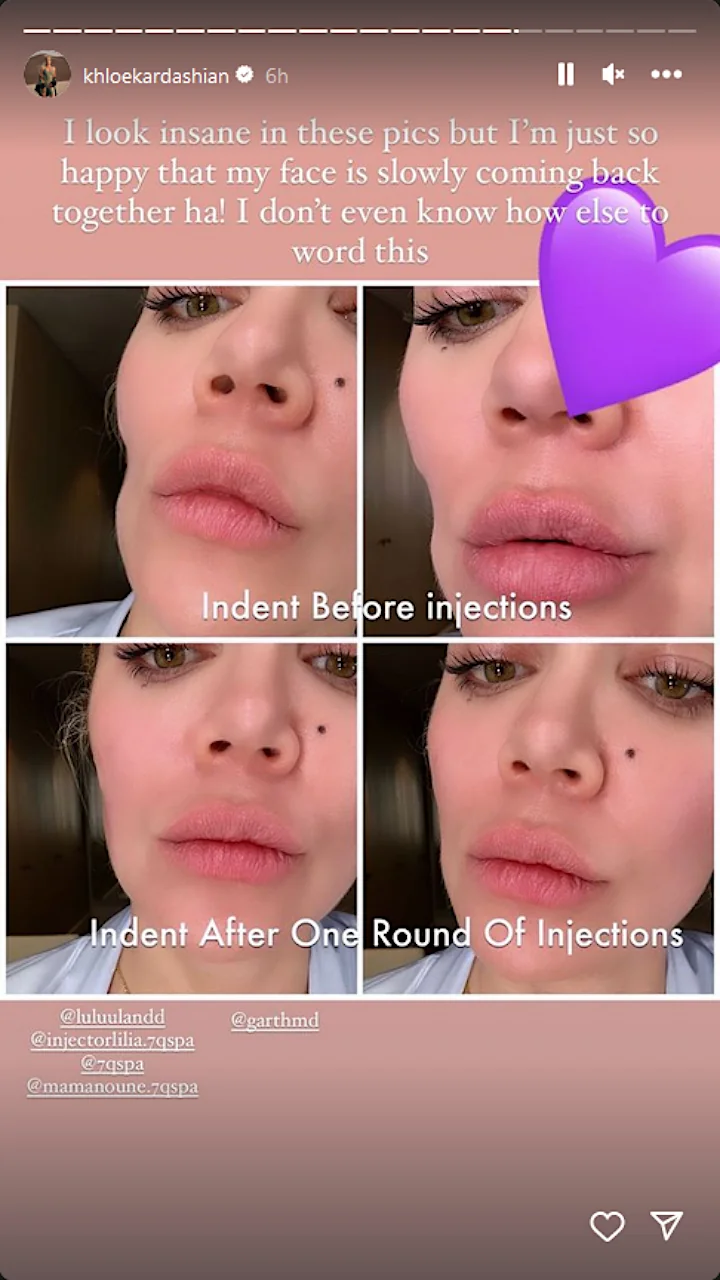 Khloe Kardashian's IG Story