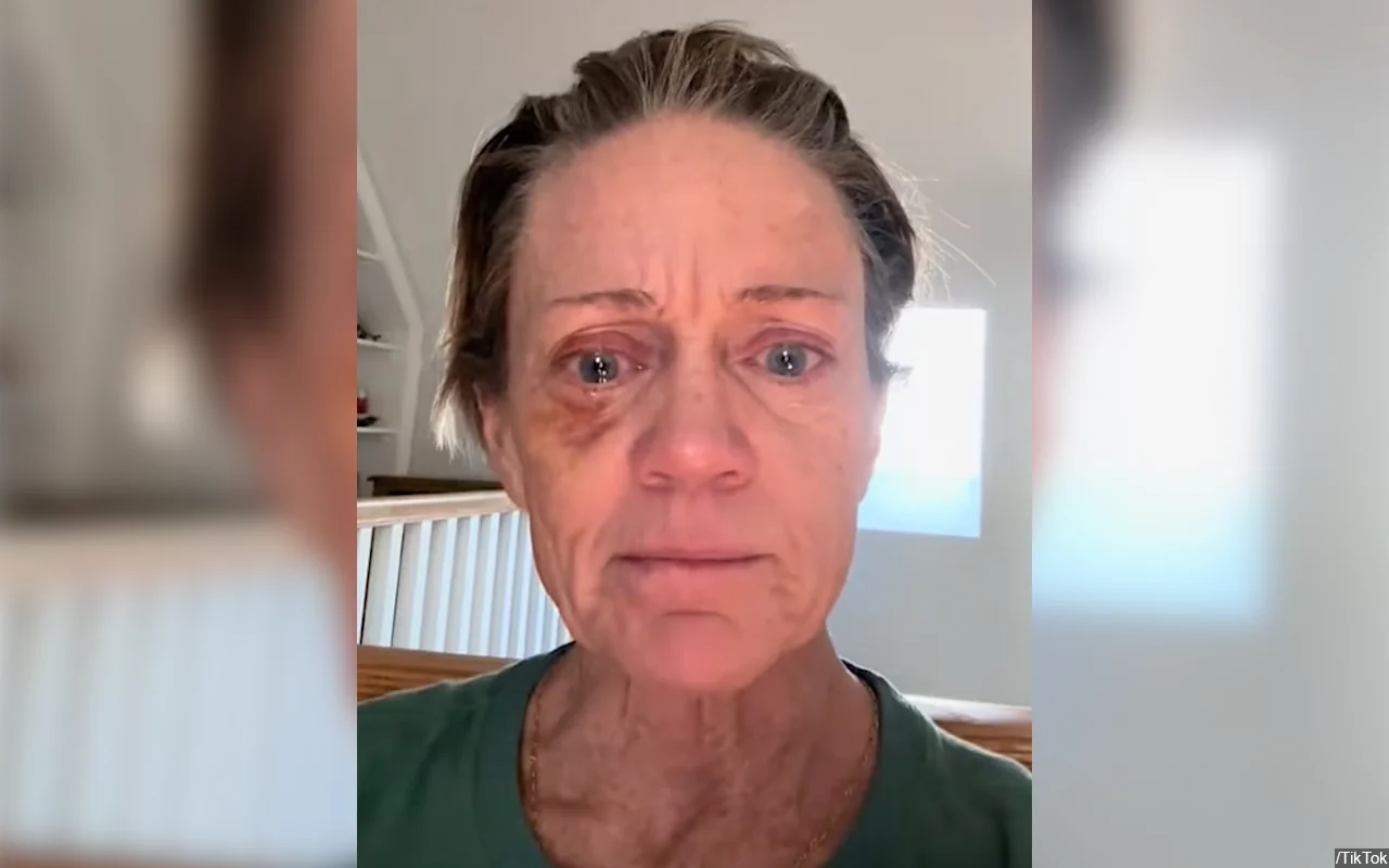 Former Miss America Runner-Up Cullen Johnson Hill Says Addiction Makes Her Look Like 'Crap'