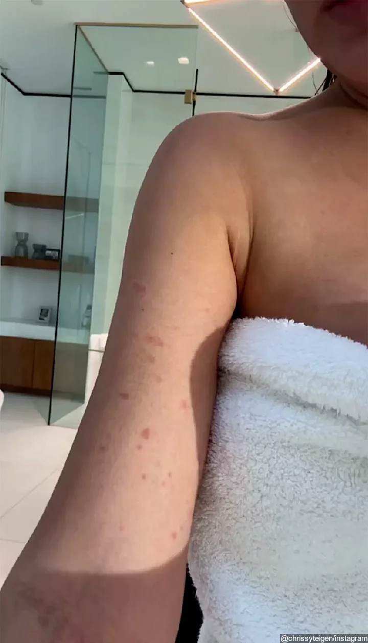 Chrissy Teigen Photo