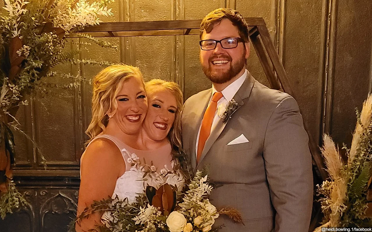 Conjoined Twin Abby Hensel Ties the Knot With Josh Bowling