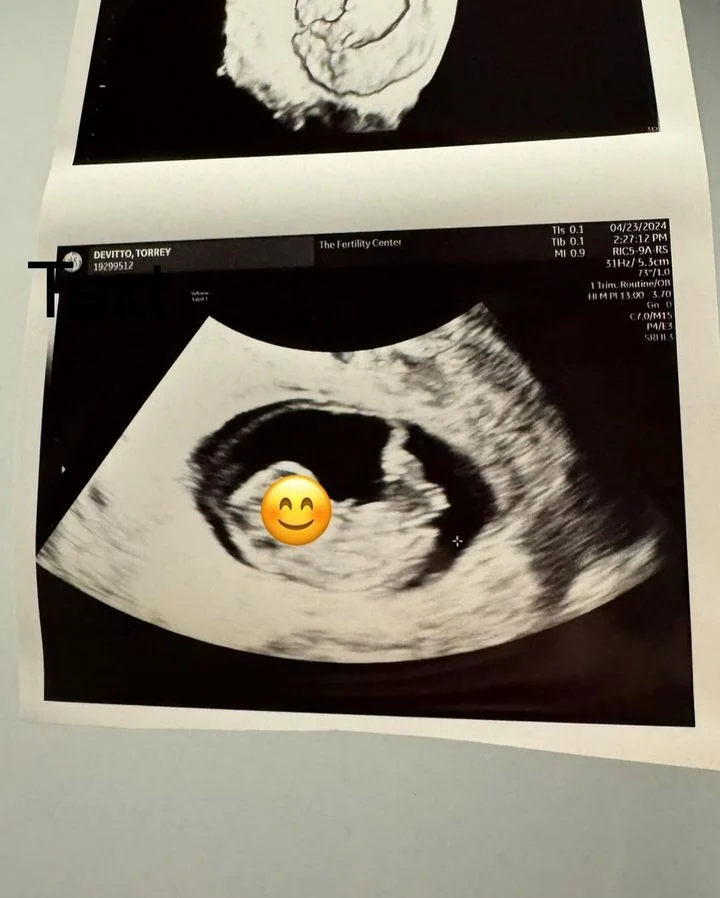 Torrey DeVitto's fiance shares her sonogram