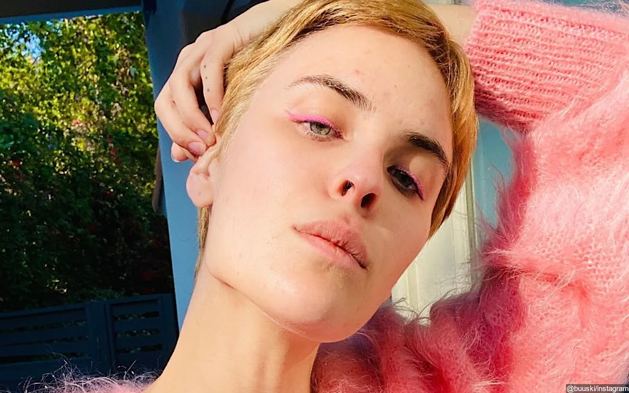 Tallulah Willis Shares Shocking Before-and-After Photos Amid Battle With Skin Picking Disorder