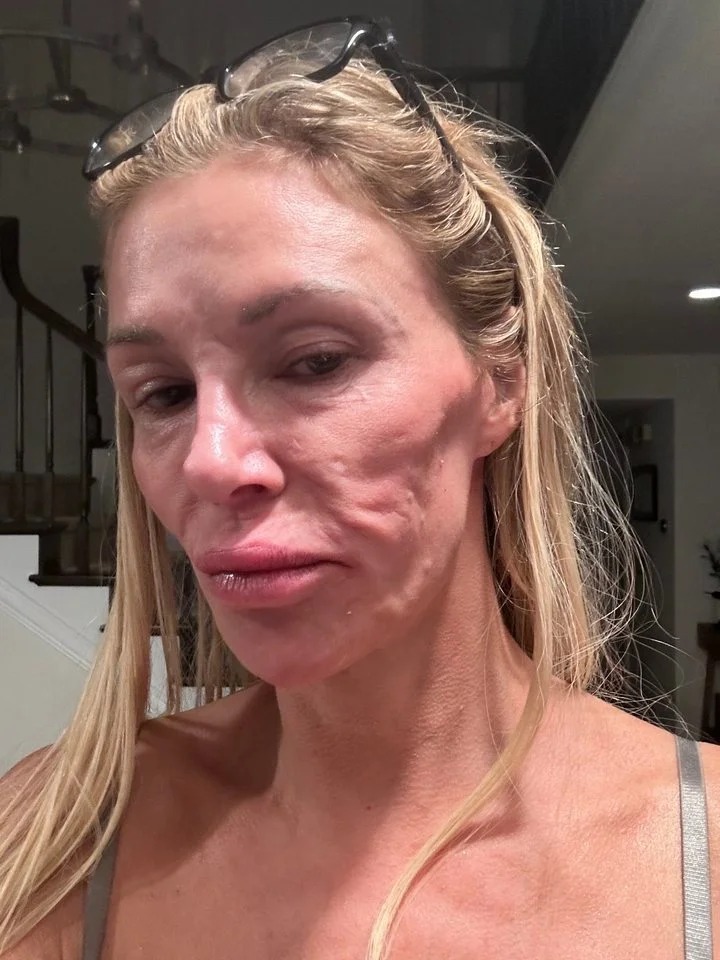 Grandi Glanville shares her battle with skin condition