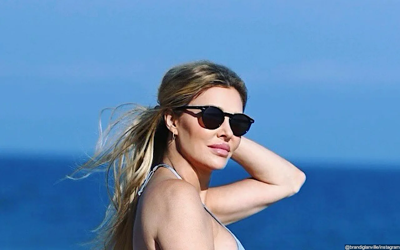 Brandi Glanville May Undergo Surgery to Repair Face Amid Severe Skin Condition