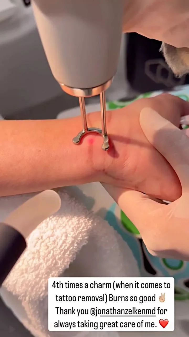 Christina Haack undergoes another tattoo removal