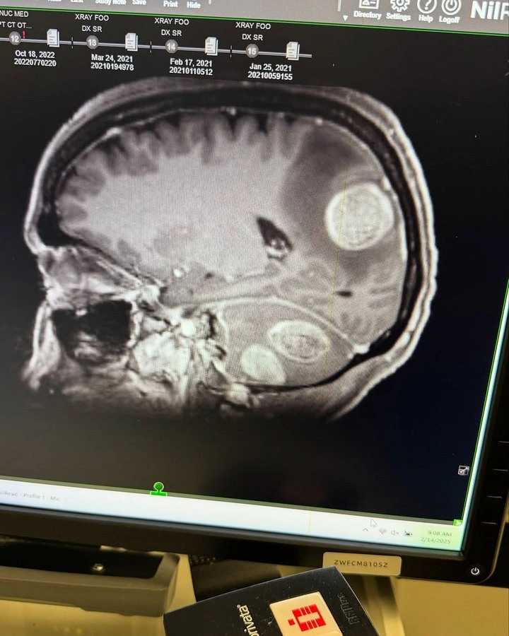 Teddi Mellencamp shows her brain scan