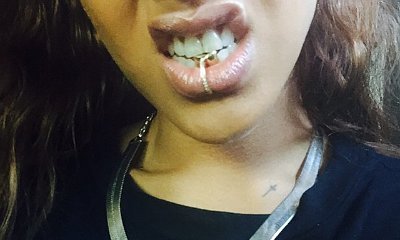 Rihanna Flashes Mouth Rings on Instagram Photos