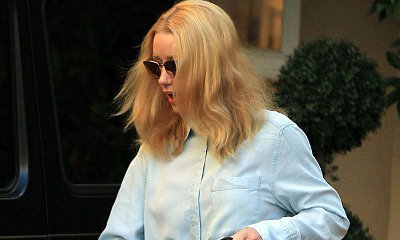 Iggy Azalea Spotted With Bandaged Fingers After Removing A$AP Rocky Tribute Tattoo