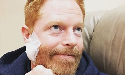 Jesse Tyler Ferguson Shows Bandaged Face After Treated for Cancer