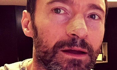 Hugh Jackman Is Treated for Skin Cancer Again, Reminds Fans to 'Wear Sunscreen'