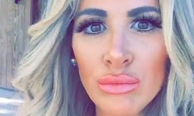 Kim Zolciak Fights Back Against Haters After They Slammed Her Pouty Lips