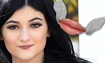 Is Kylie Jenner Going to Ditch Her Pouty Lips?