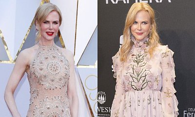 Nicole Kidman Sparks Plastic Surgery Speculations