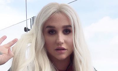 Makeup-Free Kesha Shows Her Freckles in New Selfie