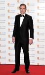 Calling Going Bald 'Horrible', James Nesbitt Had Two Hair Transplants