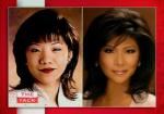 Julie Chen's Eyes Surgery Revelation Receives Mixed Responses