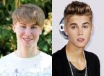 Justin Bieber Fan Spends $100,000 on Plastic Surgery to Look Like the Pop Star