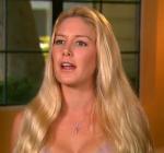 Heidi Montag Removes F-Cup Breast Implants Due to Health Issues