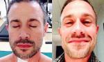 Freddie Prinze Jr. Shares New Photo After Getting His Stitches Removed