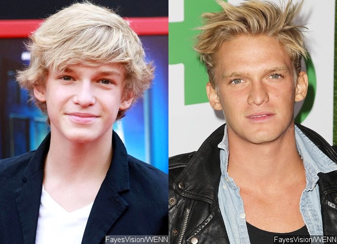 Cody Simpson Sparks Nose Job Speculations See The Difference