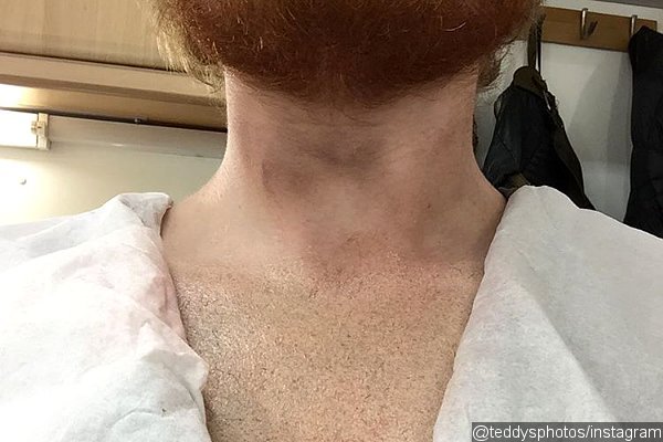 Ed Sheeran's Giant Lion Tattoo NOT Real