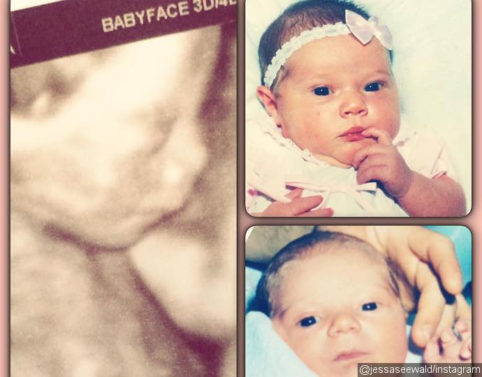 Jessa Duggar Compares Baby's Ultrasound to Her and Husband's Photos as Babies