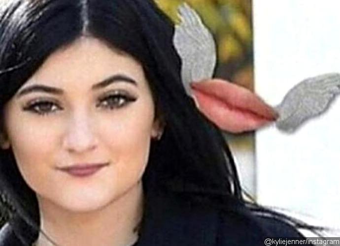 Is Kylie Jenner Going To Ditch Her Pouty Lips Is Kylie Jenner Going To Ditch Her Pouty Lips