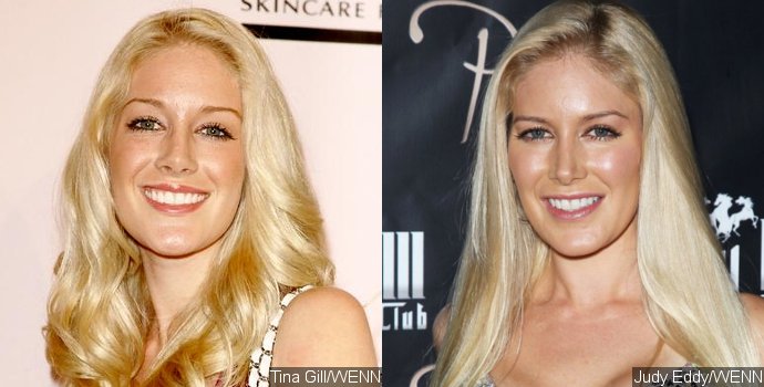 Celebrities Who Regret Getting Plastic Surgery