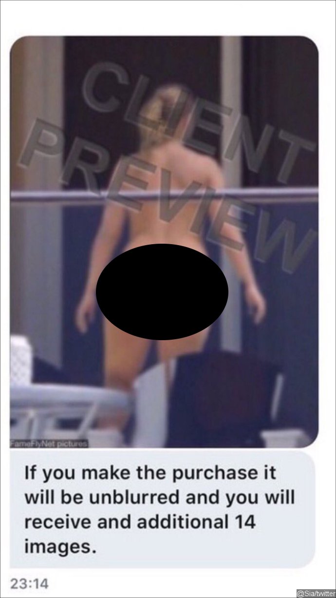 Sia Shares Her Naked Picture 'for Free' to Fight Back Paparazzo