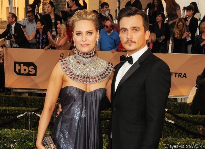 Homeland Star Rupert Friend Elopes With Aimee Mullins