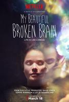 My Beautiful Broken Brain (2016) Profile Photo