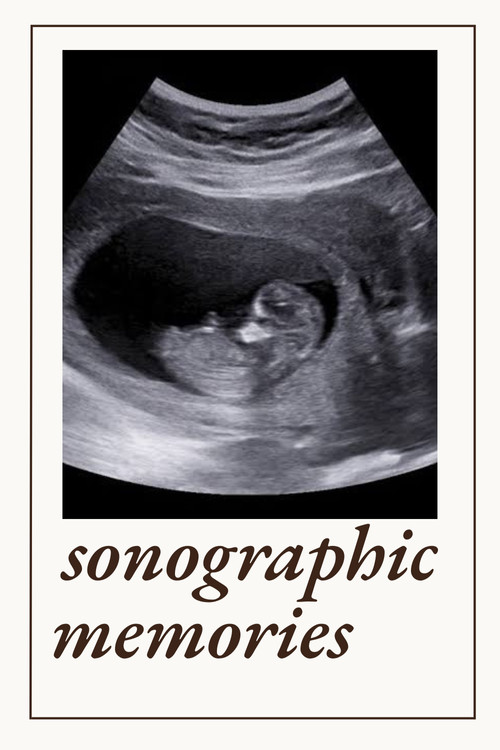 Sonographic Memories