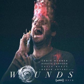 Poster of Hulu' Wounds (2019)