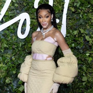 Winnie Harlow