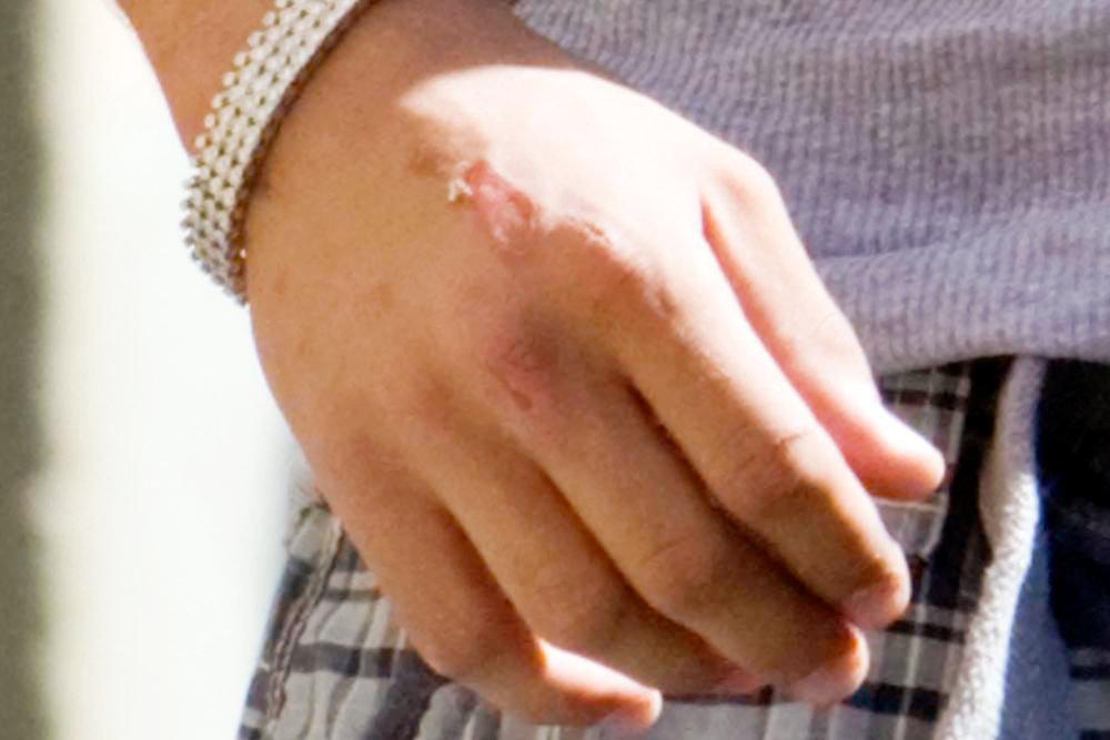 Ronnie Ortiz-Magro;<br>Ronnie Ortiz-Magro Applies a Bandage After Punching Mike 'The Situation'